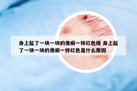身上起了一塊一塊的像癬一樣紅色癢 身上起了一塊一塊的像癬一樣紅色是什么原因