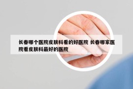 長春哪個醫(yī)院皮膚科看的好醫(yī)院 長春哪家醫(yī)院看皮膚科最好的醫(yī)院