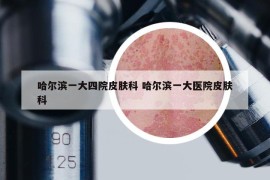 哈爾濱一大四院皮膚科 哈爾濱一大醫(yī)院皮膚科