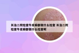 長治二院檢查牛皮癬都做什么檢查 長治二院檢查牛皮癬都做什么檢查呢
