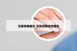 花癬初期圖片 花蘚初期癥狀圖片