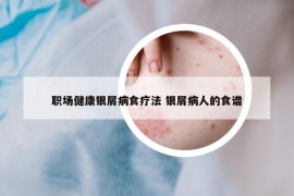 職場(chǎng)健康銀屑病食療法 銀屑病人的食譜