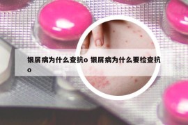 銀屑病為什么查抗o 銀屑病為什么要檢查抗o