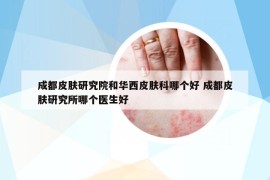 成都皮膚研究院和華西皮膚科哪個好 成都皮膚研究所哪個醫(yī)生好