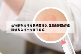 生物制劑治療皮膚病要多久 生物制劑治療皮膚病多久打一次能生育嗎
