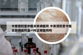 中原德懿堂中醫(yī)皮膚病醫(yī)院 中原德懿堂中醫(yī)皮膚病醫(yī)院是一所正規(guī)醫(yī)院嗎