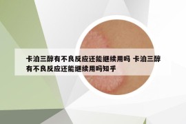 卡泊三醇有不良反應(yīng)還能繼續(xù)用嗎 卡泊三醇有不良反應(yīng)還能繼續(xù)用嗎知乎