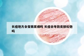 長痘地方會變銀屑病嗎 長痘會導致皮膚松弛嗎