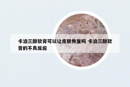 卡泊三醇軟膏可以讓皮膚恢復(fù)嗎 卡泊三醇軟膏的不良反應(yīng)