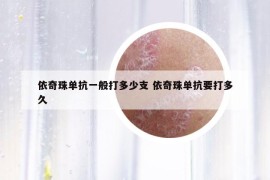 依奇珠單抗一般打多少支 依奇珠單抗要打多久