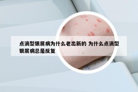 點滴型銀屑病為什么老出新的 為什么點滴型銀屑病總是反復