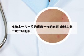 皮膚上一片一片的像癬一樣的東西 皮膚上長一塊一塊的癬