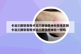 卡泊三醇軟膏和卡泊三醇倍他米松軟膏區(qū)別 卡泊三醇軟膏和卡泊三醇倍他米松一樣嗎