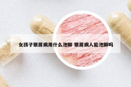 女孩子銀屑病用什么泡腳 銀屑病人能泡腳嗎