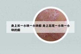 身上長(zhǎng)一小塊一小塊癬 身上出現(xiàn)一小塊一小塊的癬