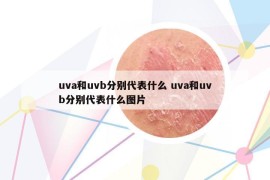 uva和uvb分別代表什么 uva和uvb分別代表什么圖片