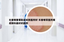 長(zhǎng)春哪里看臉部皮膚醫(yī)院好 長(zhǎng)春哪家醫(yī)院看皮膚科最好的醫(yī)院