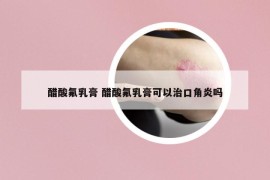 醋酸氟乳膏 醋酸氟乳膏可以治口角炎嗎