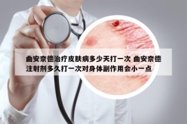 曲安奈德治療皮膚病多少天打一次 曲安奈德注射劑多久打一次對身體副作用會小一點(diǎn)