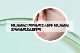 腿肚后面起三塊白色斑怎么回事 腿肚后面起三塊白色斑怎么回事啊