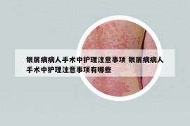 銀屑病病人手術(shù)中護(hù)理注意事項(xiàng) 銀屑病病人手術(shù)中護(hù)理注意事項(xiàng)有哪些
