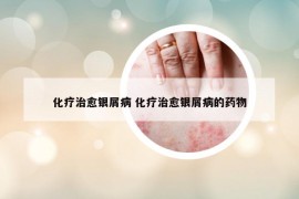 化療治愈銀屑病 化療治愈銀屑病的藥物