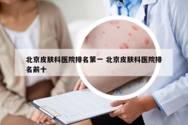 北京皮膚科醫(yī)院排名第一 北京皮膚科醫(yī)院排名前十