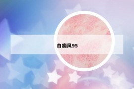 白癜風(fēng)95