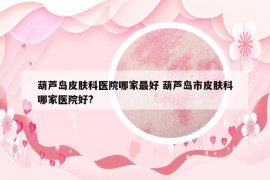 葫蘆島皮膚科醫(yī)院哪家最好 葫蘆島市皮膚科哪家醫(yī)院好?