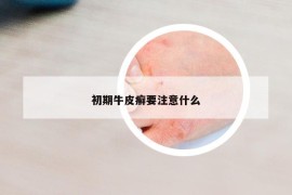 初期牛皮癬要注意什么