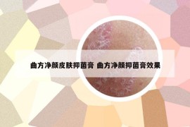 曲方凈顏皮膚抑菌膏 曲方凈顏抑菌膏效果