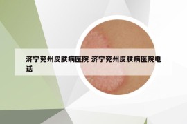 濟寧兗州皮膚病醫(yī)院 濟寧兗州皮膚病醫(yī)院電話