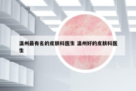 溫州最有名的皮膚科醫(yī)生 溫州好的皮膚科醫(yī)生