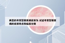 典型的尋常型銀屑病皮損為 試述尋常型銀屑病的皮損特點和臨床分期