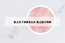 臉上長了塊癬怎么辦 臉上起小塊癬