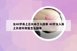 女40歲身上總長癬怎么回事 40歲女人身上長老年斑是怎么回事