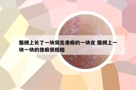 胳膊上長(zhǎng)了一塊突出像癬的一塊皮 胳膊上一塊一塊的像癬很粗糙