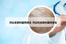 河北皮膚科醫(yī)院排名 河北的皮膚科醫(yī)院排名