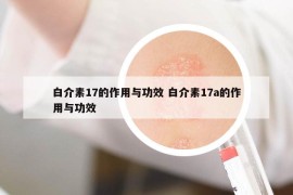 白介素17的作用與功效 白介素17a的作用與功效