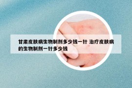 甘肅皮膚病生物制劑多少錢一針 治療皮膚病的生物制劑一針多少錢