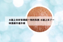 小腿上長好多跟蘚一樣的東西 小腿上長了一塊像癬不痛不癢