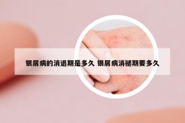 銀屑病的消退期是多久 銀屑病消褪期要多久