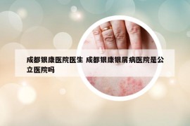 成都銀康醫(yī)院醫(yī)生 成都銀康銀屑病醫(yī)院是公立醫(yī)院嗎