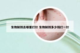 生物制劑去哪里打針 生物制劑多少錢打一針