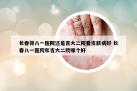 長春得八一醫(yī)院還是吉大二院看皮膚病好 長春八一醫(yī)院和吉大二院哪個好