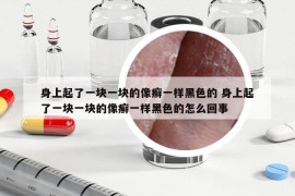 身上起了一塊一塊的像癬一樣黑色的 身上起了一塊一塊的像癬一樣黑色的怎么回事