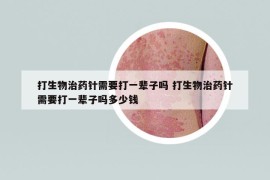 打生物治藥針需要打一輩子嗎 打生物治藥針需要打一輩子嗎多少錢