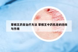 草根王藥膏治療方法 草根王中藥乳膏的功效與作用