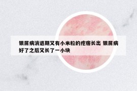 銀屑病消退期又有小米粒的疙瘩長(zhǎng)出 銀屑病好了之后又長(zhǎng)了一小塊