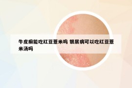 牛皮癬能吃紅豆薏米嗚 銀屑病可以吃紅豆薏米湯嗎